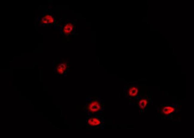 Phospho-p53 (Ser15) Antibody in Immunocytochemistry (ICC/IF)