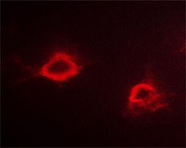 Phospho-Amyloid Precursor Protein (Thr743) Antibody in Immunocytochemistry (ICC/IF)