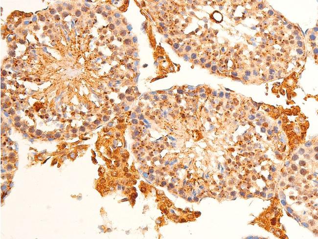 Phospho-c-Jun (Ser63) Antibody in Immunohistochemistry (Paraffin) (IHC (P))