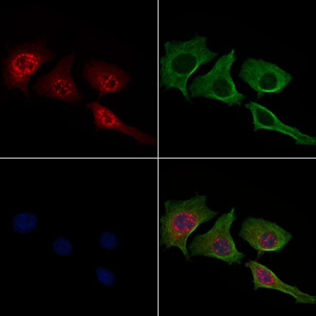 Phospho-c-Jun (Thr91) Antibody in Immunocytochemistry (ICC/IF)