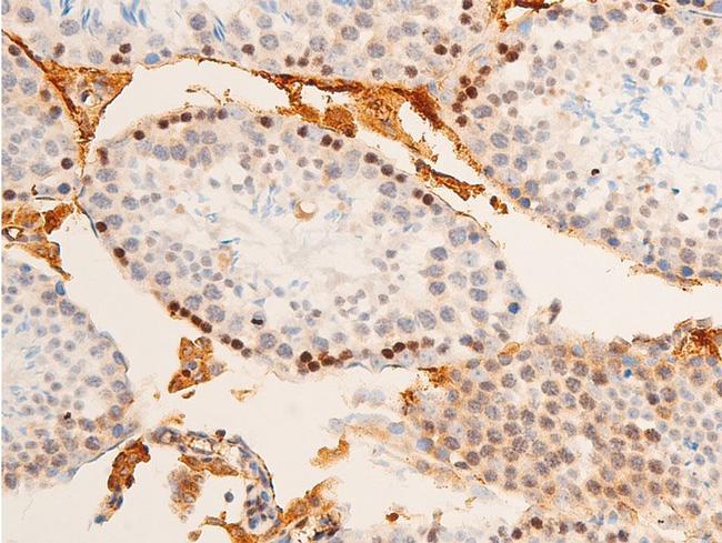 Phospho-c-Jun (Tyr170) Antibody in Immunohistochemistry (Paraffin) (IHC (P))