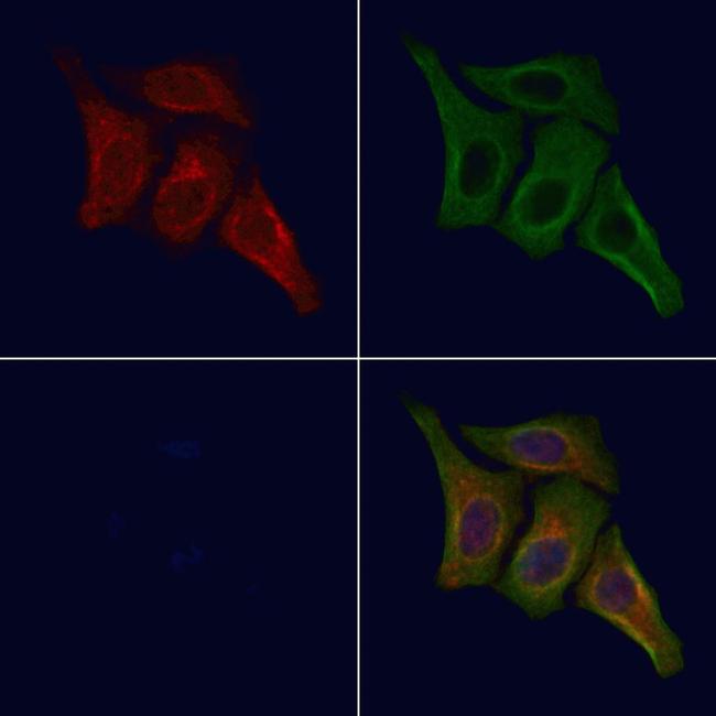 Phospho-INSR (Tyr1355) Antibody in Immunocytochemistry (ICC/IF)