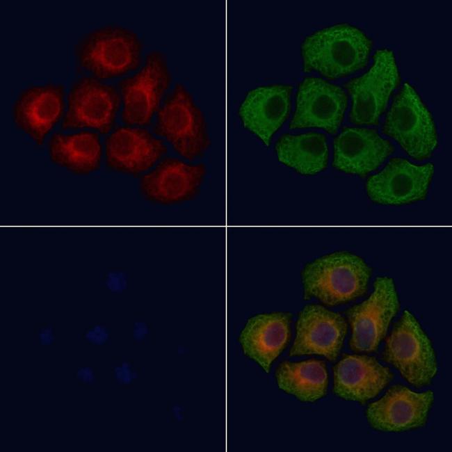 Phospho-INSR (Tyr1361) Antibody in Immunocytochemistry (ICC/IF)