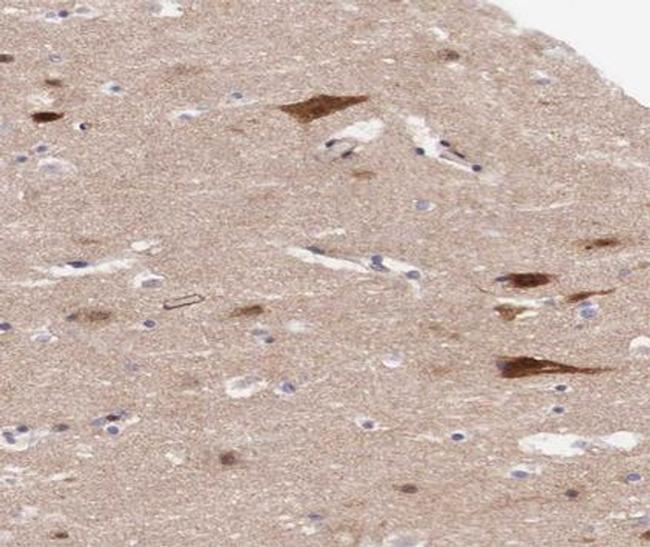 Phospho-Rb (Ser795) Antibody in Immunohistochemistry (Paraffin) (IHC (P))