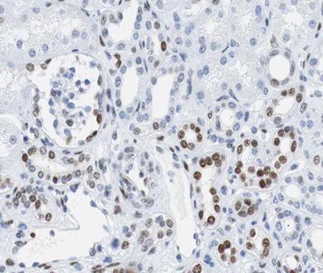 Phospho-Rb (Ser807) Antibody in Immunohistochemistry (Paraffin) (IHC (P))