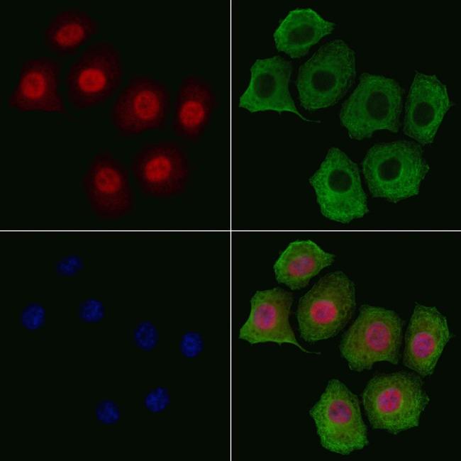 Phospho-Tyrosine Hydroxylase (Ser31) Antibody in Immunocytochemistry (ICC/IF)