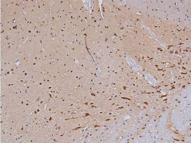 Phospho-Tyrosine Hydroxylase (Ser40) Antibody in Immunohistochemistry (Paraffin) (IHC (P))