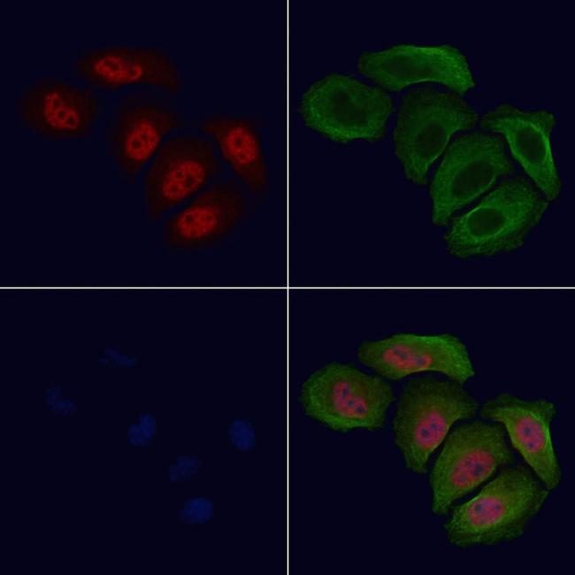 Phospho-Tyrosine Hydroxylase (Ser19) Antibody in Immunocytochemistry (ICC/IF)