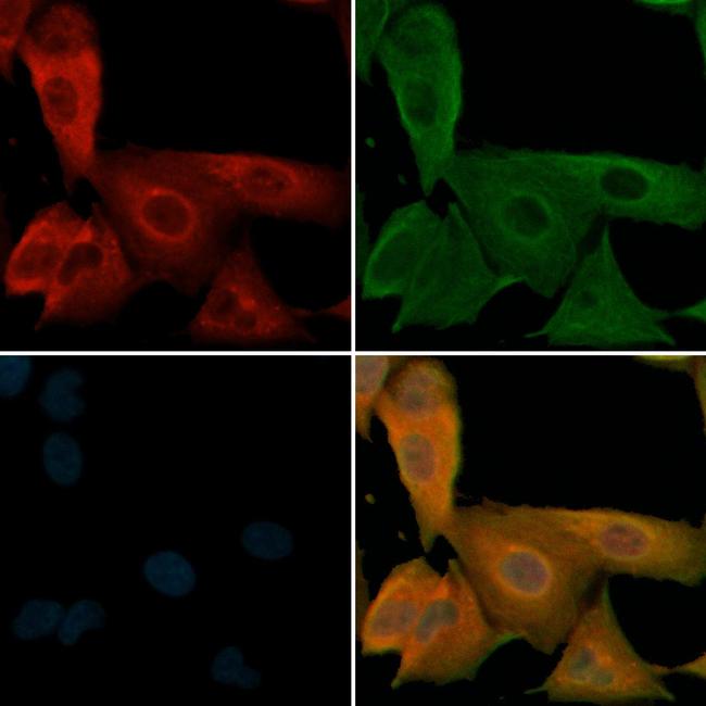 Phospho-beta-2 Adrenergic Receptor (Ser346) Antibody in Immunocytochemistry (ICC/IF)