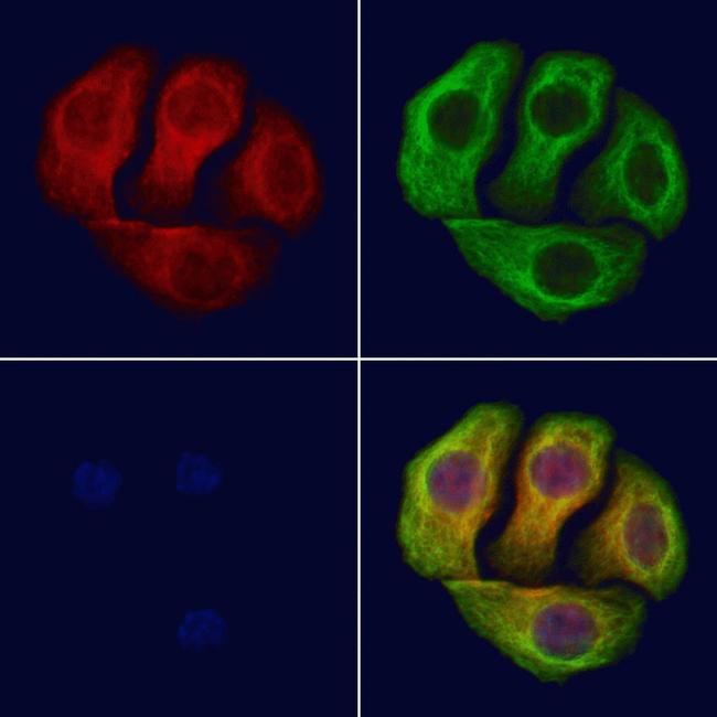 Phospho-IGF1R (Tyr1346) Antibody in Immunocytochemistry (ICC/IF)