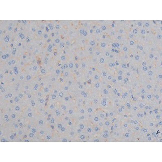 Phospho-IGF1R (Tyr1161) Antibody in Immunohistochemistry (Paraffin) (IHC (P))