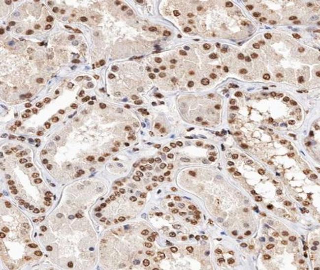 Phospho-Histone H2A (Thr121) Antibody in Immunohistochemistry (Paraffin) (IHC (P))