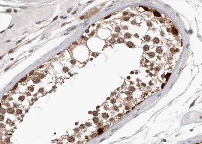 Phospho-Myb (Ser532) Antibody in Immunohistochemistry (Paraffin) (IHC (P))