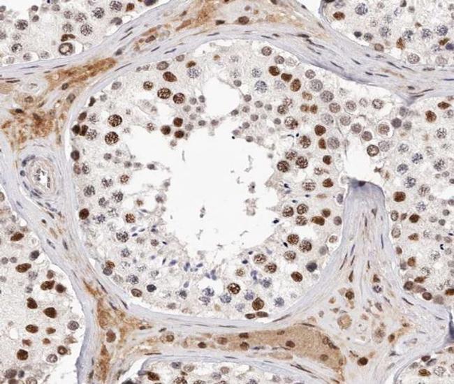 Phospho-Androgen Receptor (Ser651) Antibody in Immunohistochemistry (Paraffin) (IHC (P))