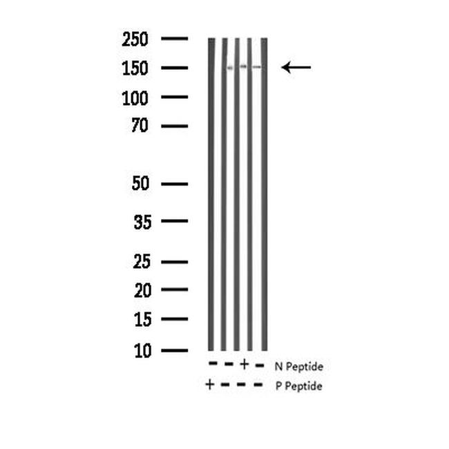 Phospho-Bcr (Tyr177) Antibody in Western Blot (WB)