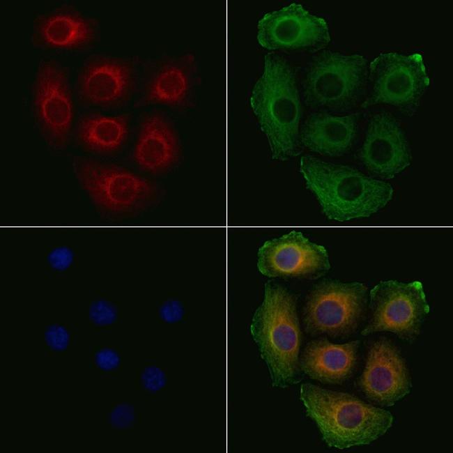 Phospho-Bcr (Tyr360) Antibody in Immunocytochemistry (ICC/IF)