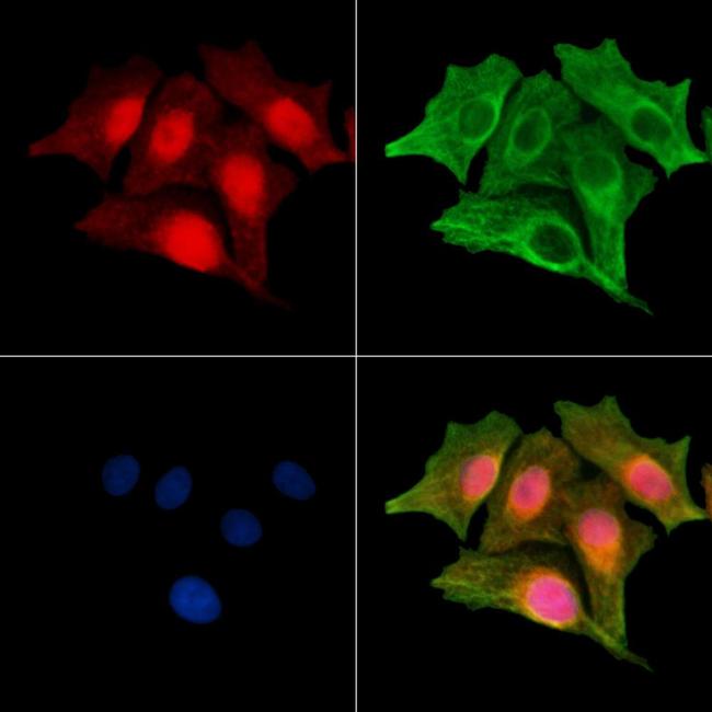 Phospho-SRF (Ser103) Antibody in Immunocytochemistry (ICC/IF)