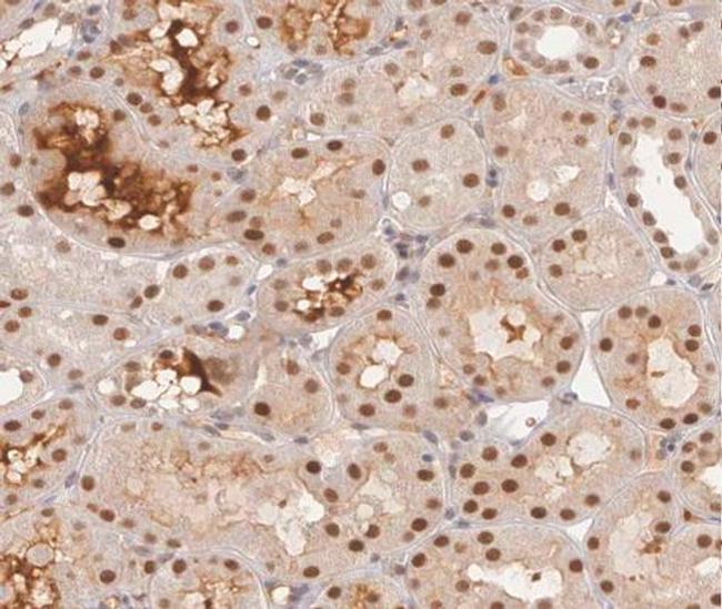 Phospho-GYS1 (Ser645) Antibody in Immunohistochemistry (Paraffin) (IHC (P))