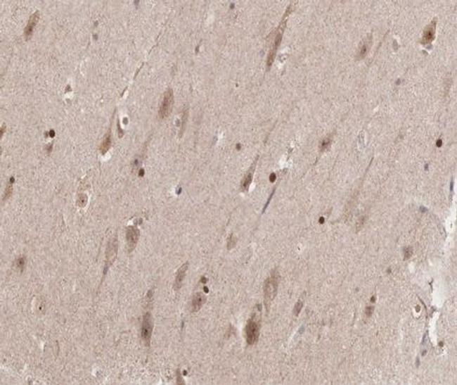 Phospho-Cyclin B1 (Ser126) Antibody in Immunohistochemistry (Paraffin) (IHC (P))