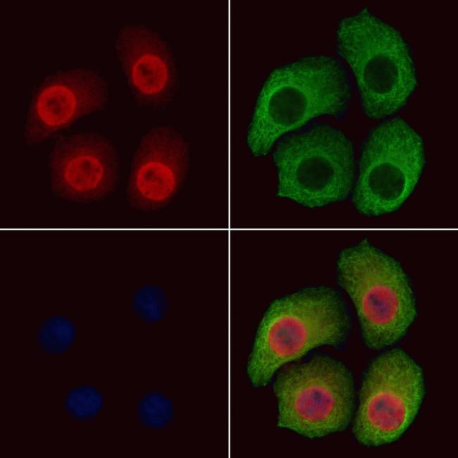 Phospho-B-RAF (Ser446) Antibody in Immunocytochemistry (ICC/IF)