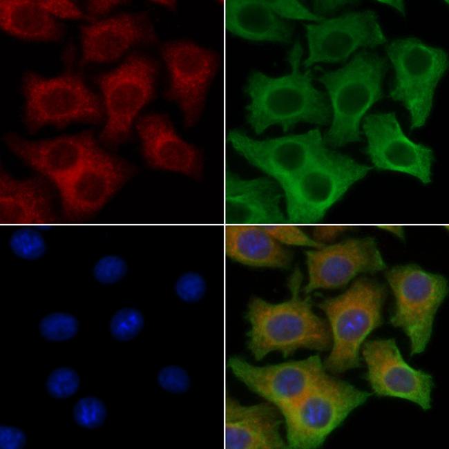 Phospho-Ezrin (Thr567) Antibody in Immunocytochemistry (ICC/IF)