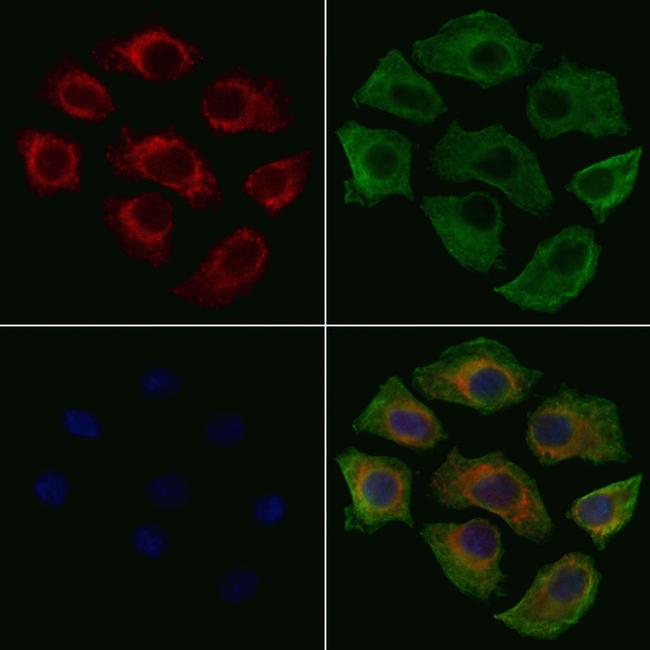 Phospho-Ezrin (Tyr354) Antibody in Immunocytochemistry (ICC/IF)