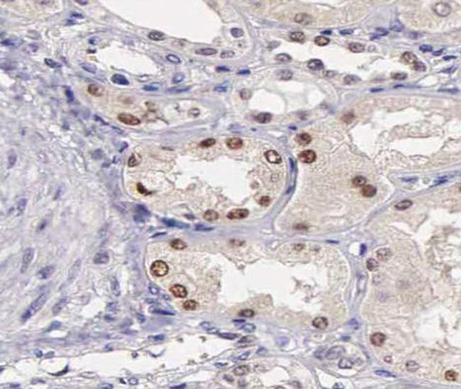 Phospho-ATF2 (Ser62, Ser44) Antibody in Immunohistochemistry (Paraffin) (IHC (P))