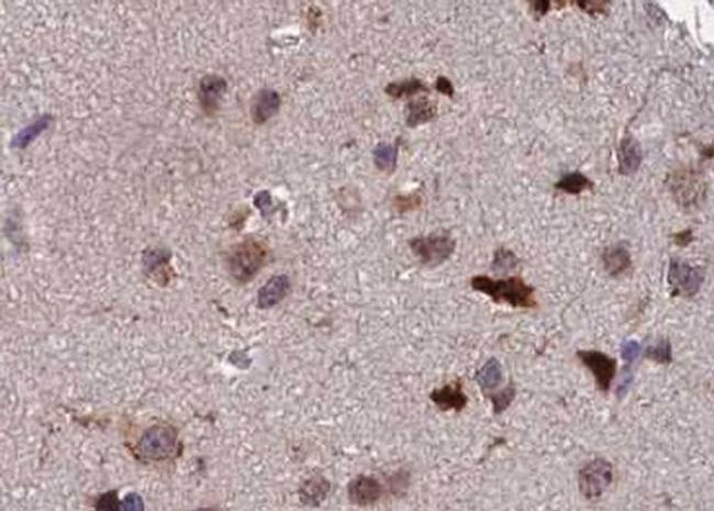 Phospho-ATF2 (Thr73, Thr55) Antibody in Immunohistochemistry (Paraffin) (IHC (P))