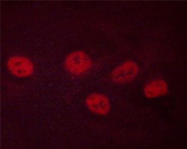 Phospho-CREB (Ser142) Antibody in Immunocytochemistry (ICC/IF)