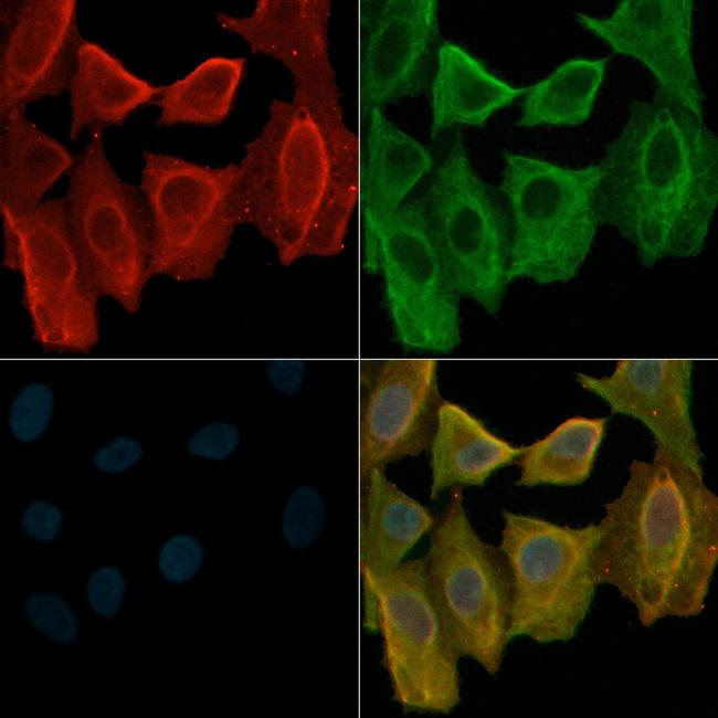 Phospho-PDGFRa (Tyr849) Antibody in Immunocytochemistry (ICC/IF)