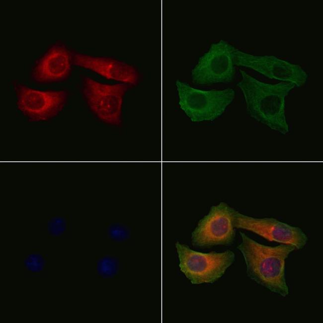 Phospho-Stathmin 1 (Ser16) Antibody in Immunocytochemistry (ICC/IF)