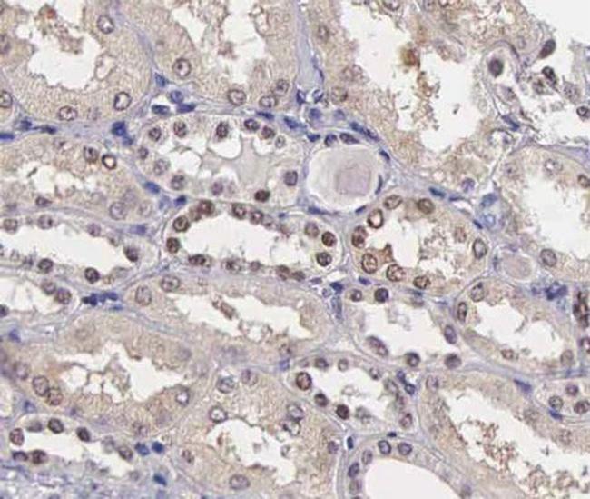 Phospho-Stathmin 1 (Ser25) Antibody in Immunohistochemistry (Paraffin) (IHC (P))