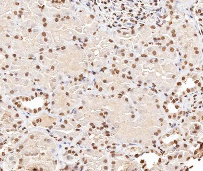 Phospho-Stathmin 1 (Ser38) Antibody in Immunohistochemistry (Paraffin) (IHC (P))