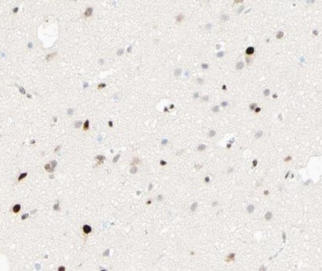 Phospho-C/EBP beta (Thr235, Thr188) Antibody in Immunohistochemistry (Paraffin) (IHC (P))