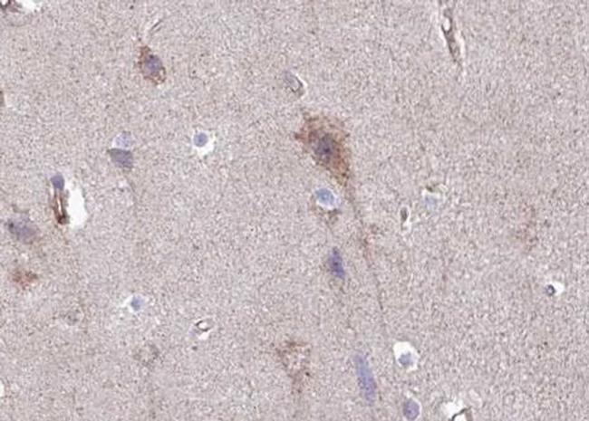 Phospho-IGFBP3 (Ser183) Antibody in Immunohistochemistry (Paraffin) (IHC (P))