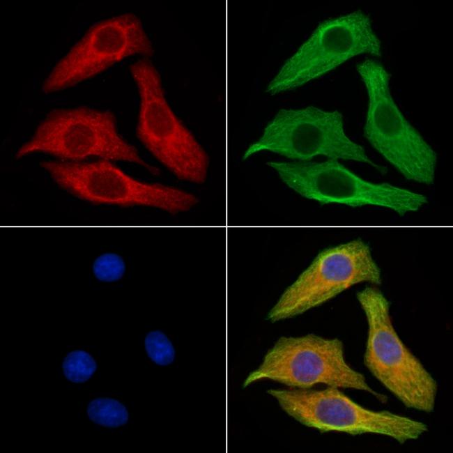 Phospho-Vinculin (Tyr822) Antibody in Immunocytochemistry (ICC/IF)