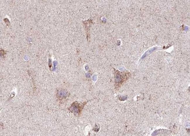 Phospho-GABRB1 (Ser434) Antibody in Immunohistochemistry (Paraffin) (IHC (P))