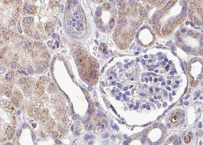 Phospho-PLCG1 (Tyr783) Antibody in Immunohistochemistry (Paraffin) (IHC (P))