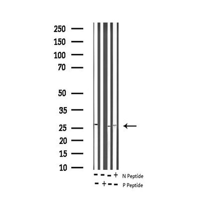 Phospho-Cardiac Troponin I (Thr143) Antibody in Western Blot (WB)