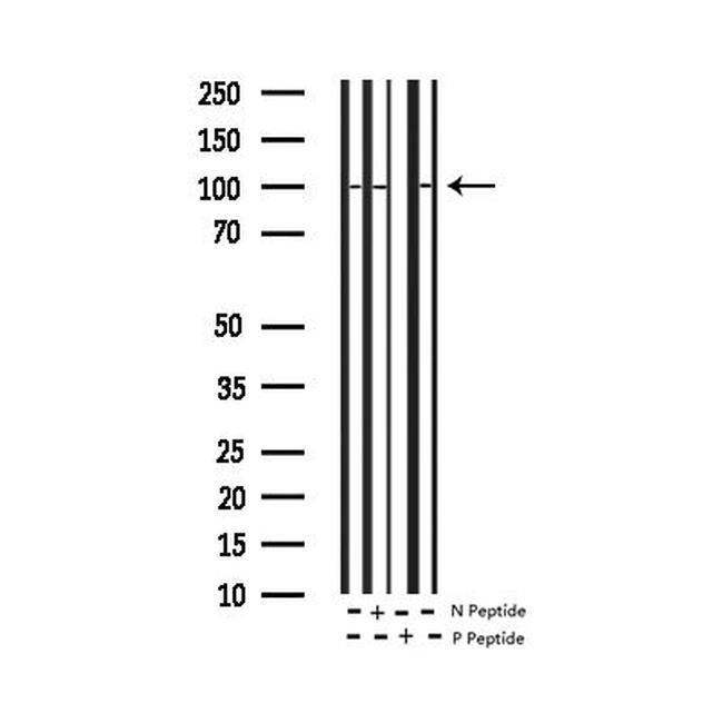 Phospho-NFkB p105/p50 (Ser932) Antibody in Western Blot (WB)