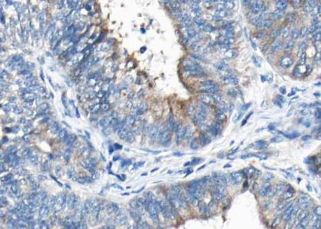 Phospho-Synaptotagmin 1/2 (Ser309) Antibody in Immunohistochemistry (Paraffin) (IHC (P))