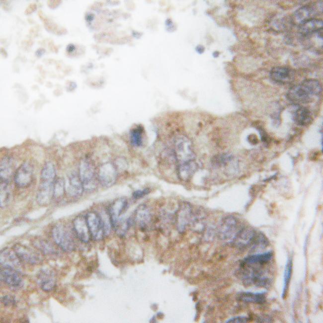 Phospho-c-Cbl (Tyr674) Antibody in Immunohistochemistry (Paraffin) (IHC (P))