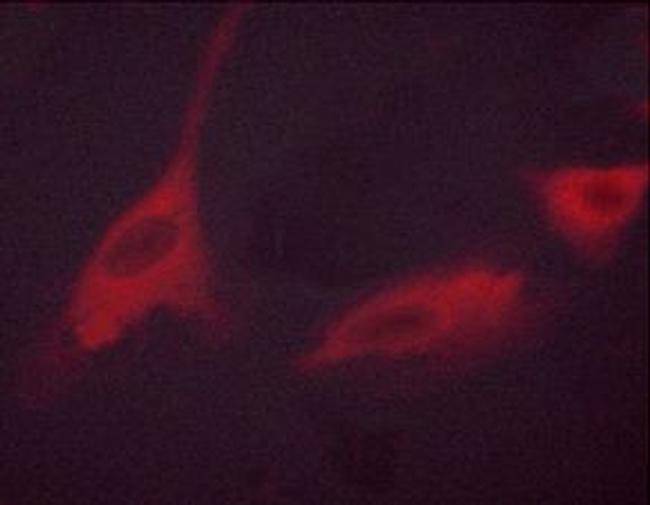 Phospho-p70 S6 Kinase (Thr389, Thr412) Antibody in Immunocytochemistry (ICC/IF)