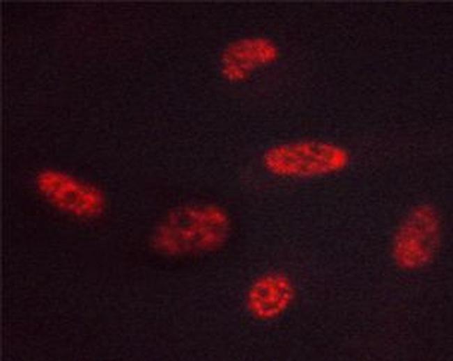 Phospho-GATA3 (Ser308) Antibody in Immunocytochemistry (ICC/IF)