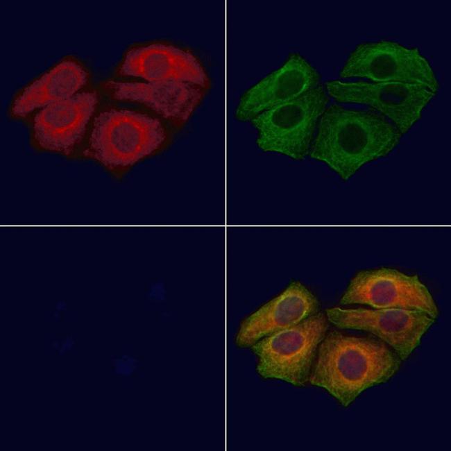 Phospho-CXCR2 (Ser347) Antibody in Immunocytochemistry (ICC/IF)