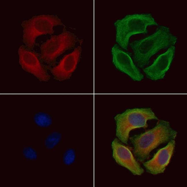 Phospho-IKB alpha (Tyr305) Antibody in Immunocytochemistry (ICC/IF)