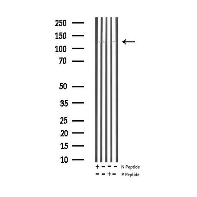 Phospho-eNOS (Thr495) Antibody in Western Blot (WB)