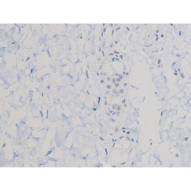 Phospho-AKT1 (Thr450) Antibody in Immunohistochemistry (Paraffin) (IHC (P))