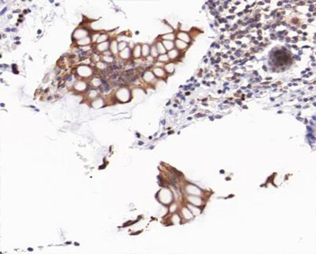 Phospho-beta Catenin (Ser37) Antibody in Immunohistochemistry (Paraffin) (IHC (P))