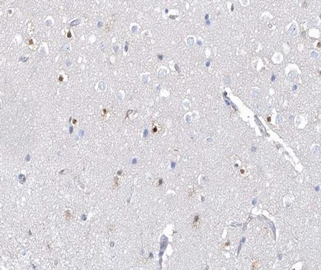 Phospho-AHR (Ser36) Antibody in Immunohistochemistry (Paraffin) (IHC (P))